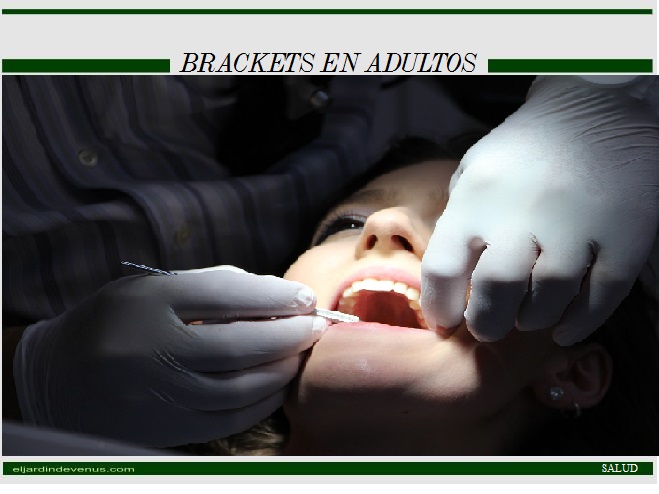 Brackets en adultos - El Jardín de Venus